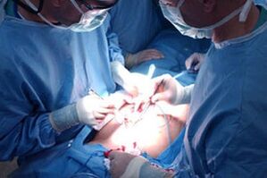 Performing an operation to increase the penis