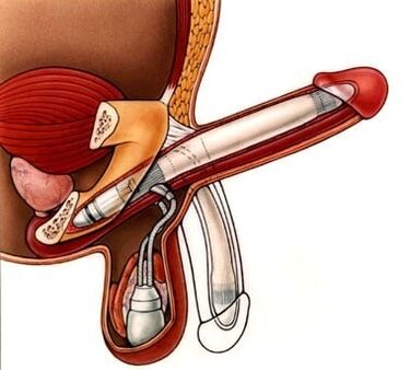 flexion of the penis for expansion